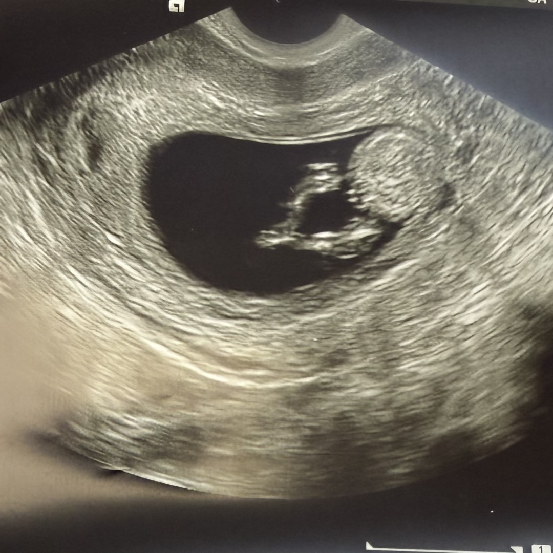 Photo shared by Chris for their Babylist baby registry.