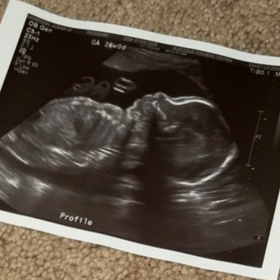 Photo shared by Aliyah for their Babylist baby registry.