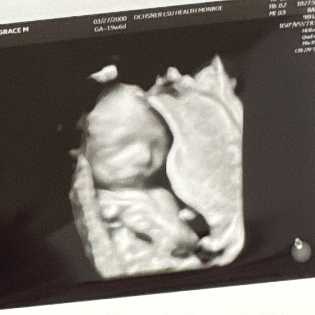 Photo shared by Grace for their Babylist baby registry.