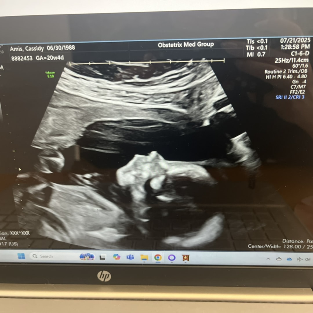 Photo shared by Stephen for their Babylist baby registry.