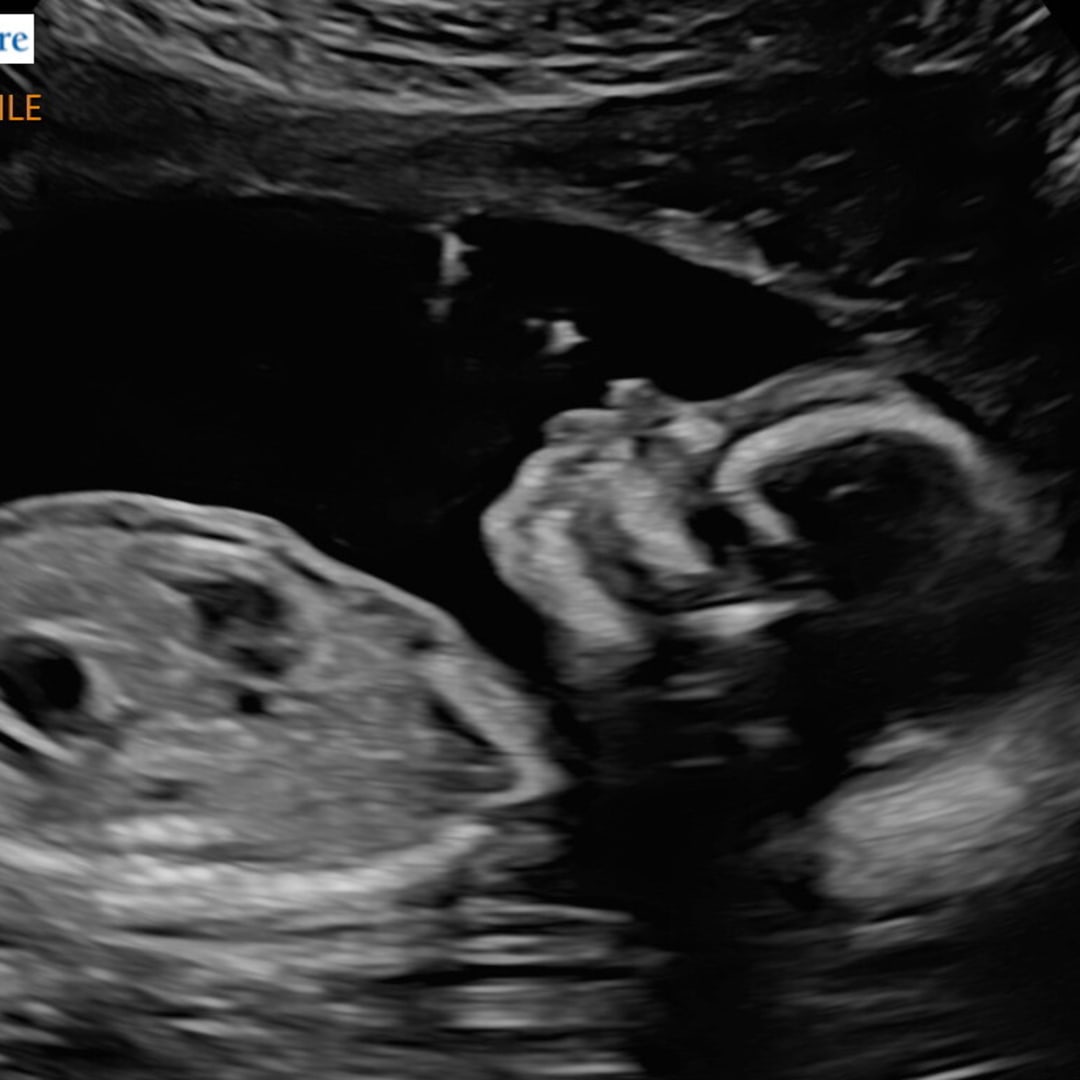 Photo shared by Erin for their Babylist baby registry.