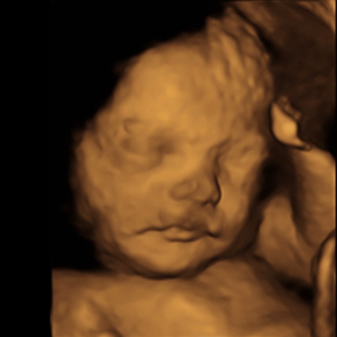 Photo shared by Abbye for their Babylist baby registry.