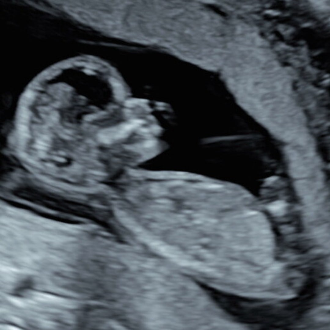 Photo shared by Ceren for their Babylist baby registry.