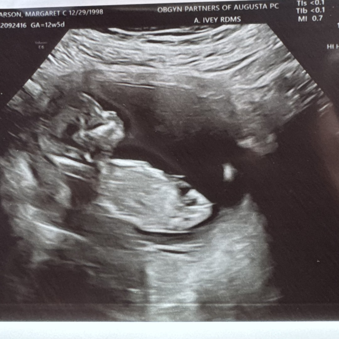 Photo shared by Carlie for their Babylist baby registry.