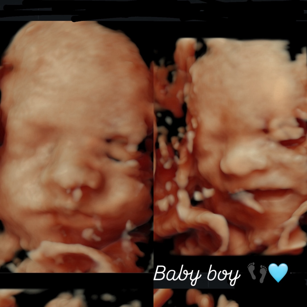 Photo shared by Maribel for their Babylist baby registry.