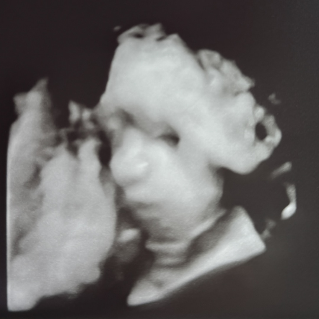 Photo shared by Arlete for their Babylist baby registry.
