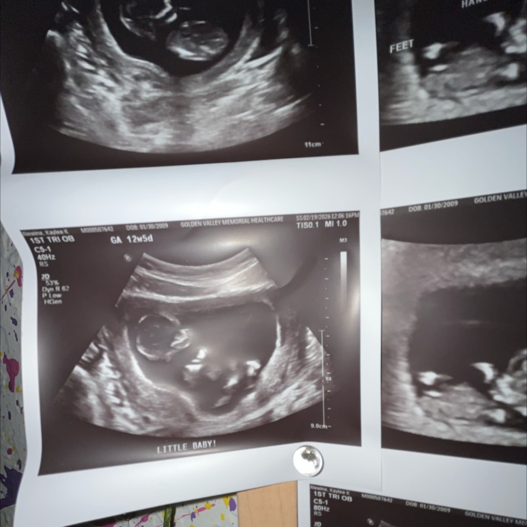 Photo shared by Kaylee for their Babylist baby registry.