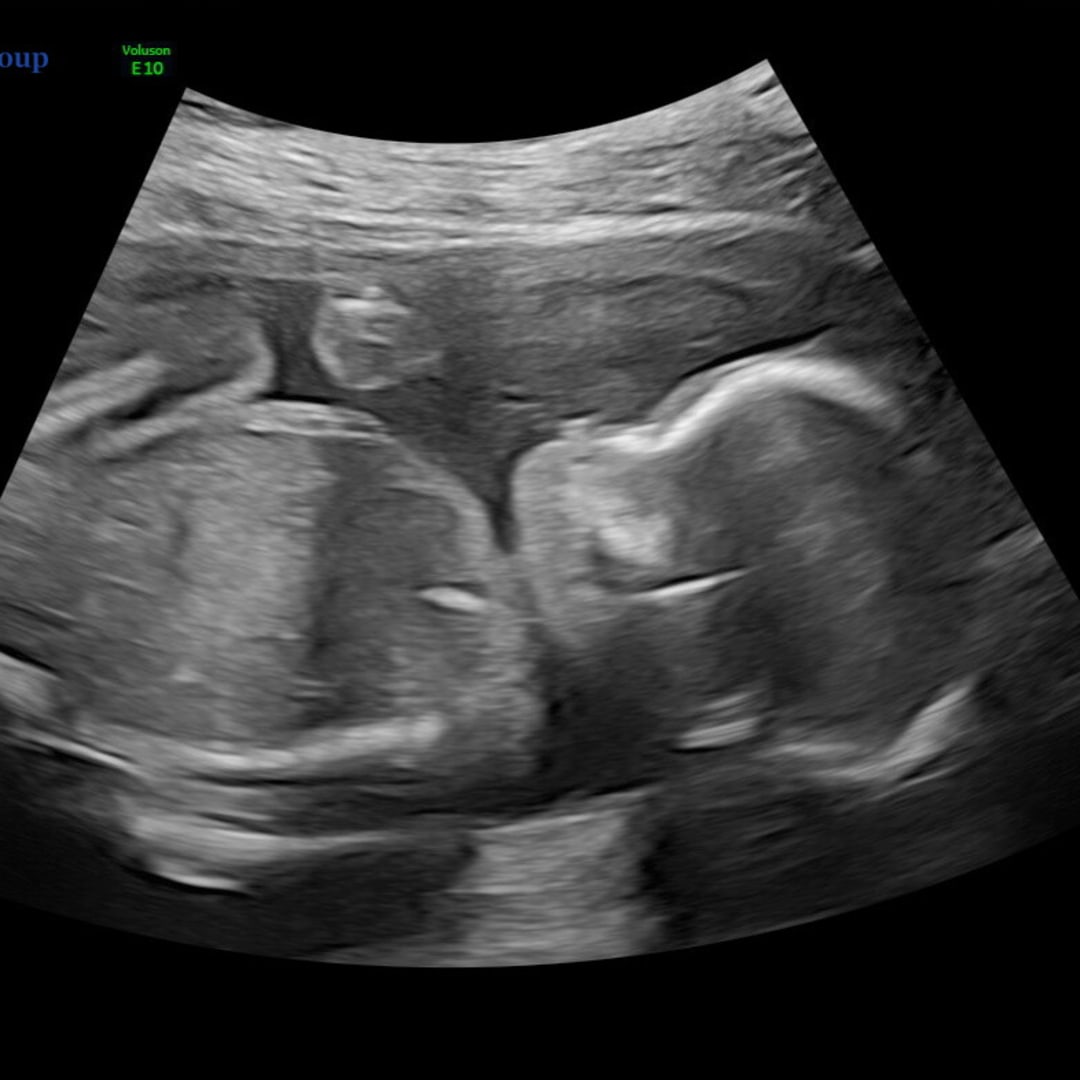 Photo shared by Danielle for their Babylist baby registry.
