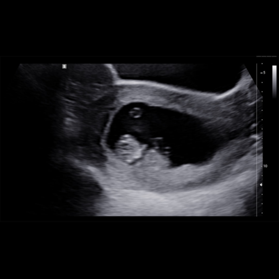 Photo shared by Hannah for their Babylist baby registry.