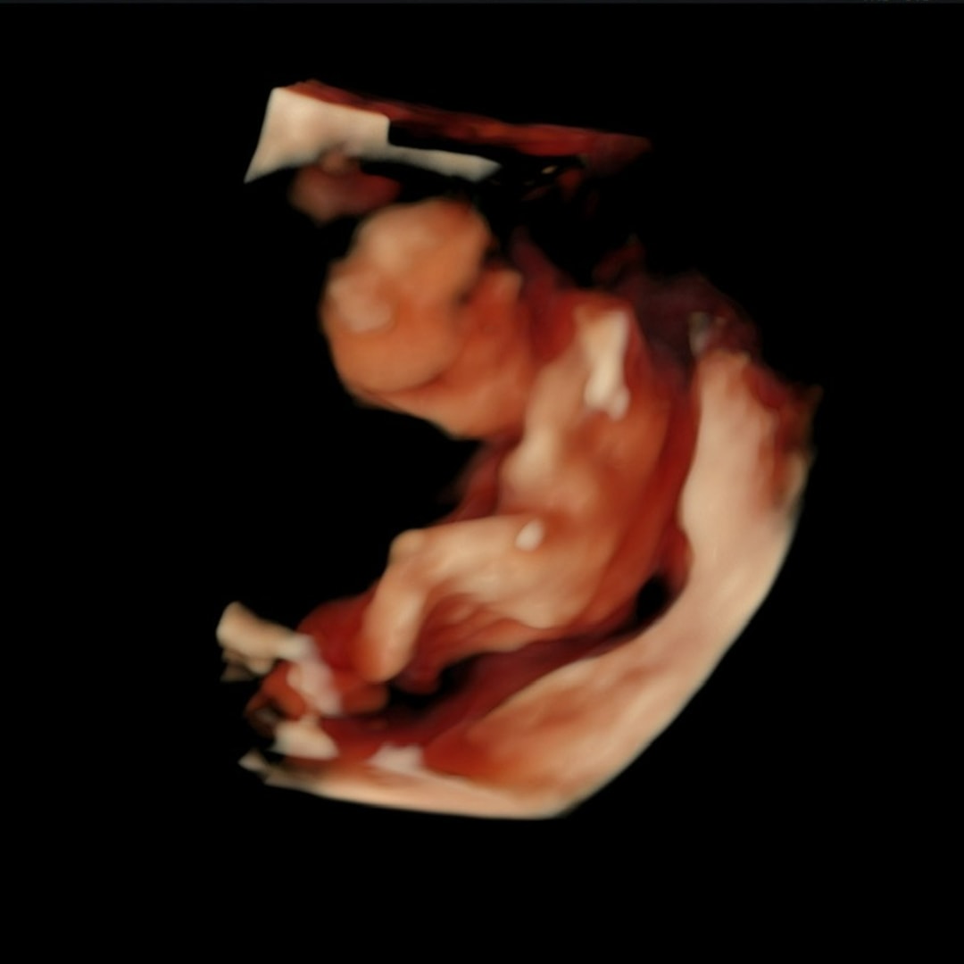 Photo shared by Hannah for their Babylist baby registry.