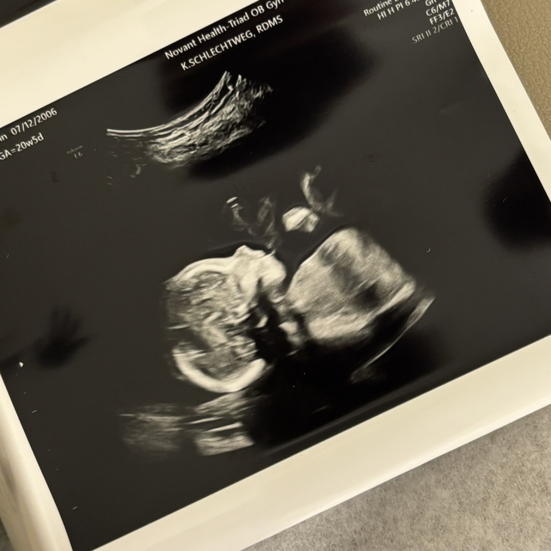 Photo shared by Leah for their Babylist baby registry.