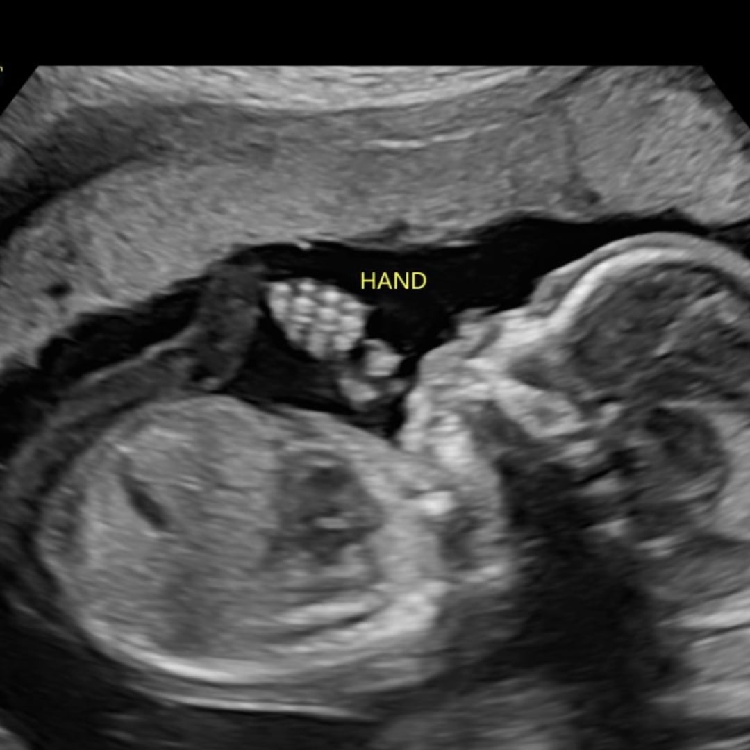 Photo shared by Erica for their Babylist baby registry.