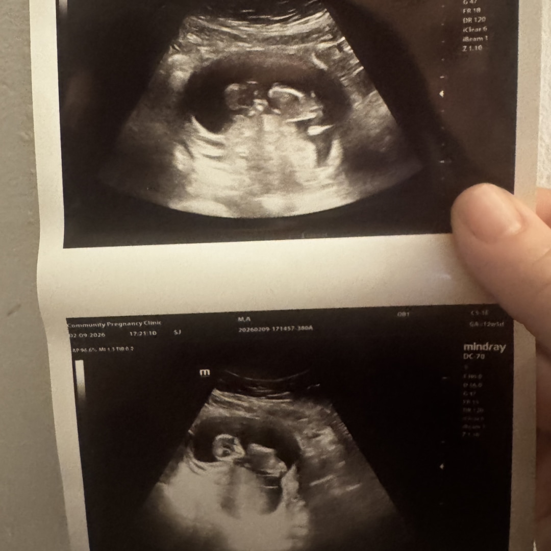 Photo shared by Ali for their Babylist baby registry.