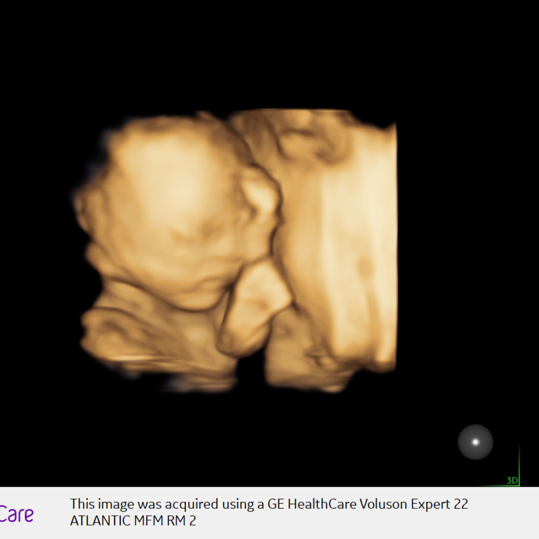 Photo shared by Christine for their Babylist baby registry.