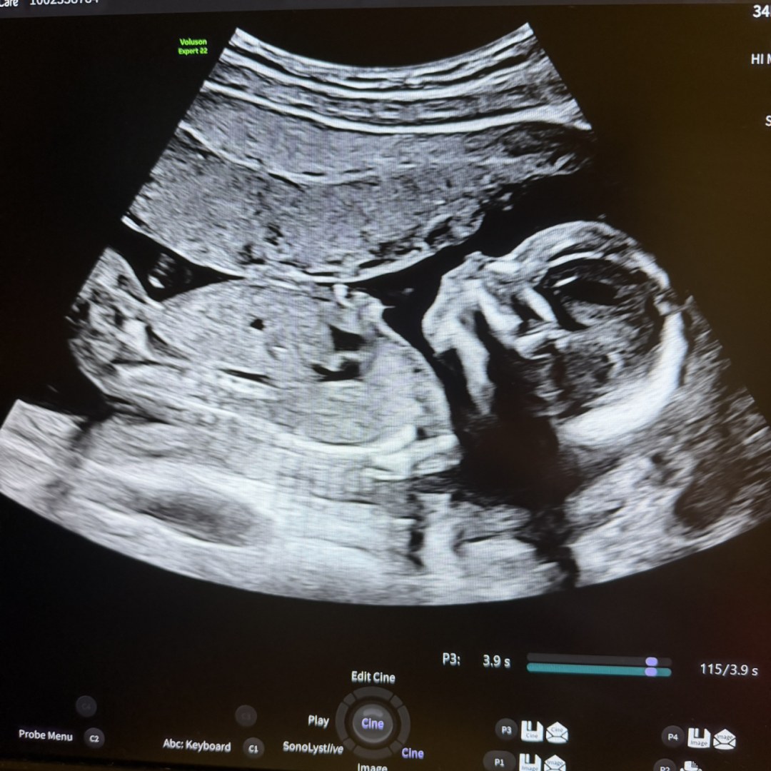 Photo shared by Shawna for their Babylist baby registry.