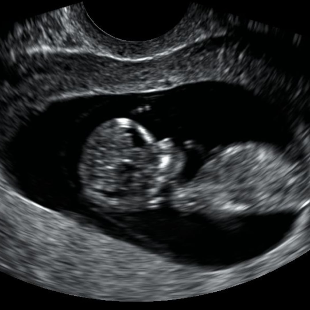 Photo shared by Jai for their Babylist baby registry.