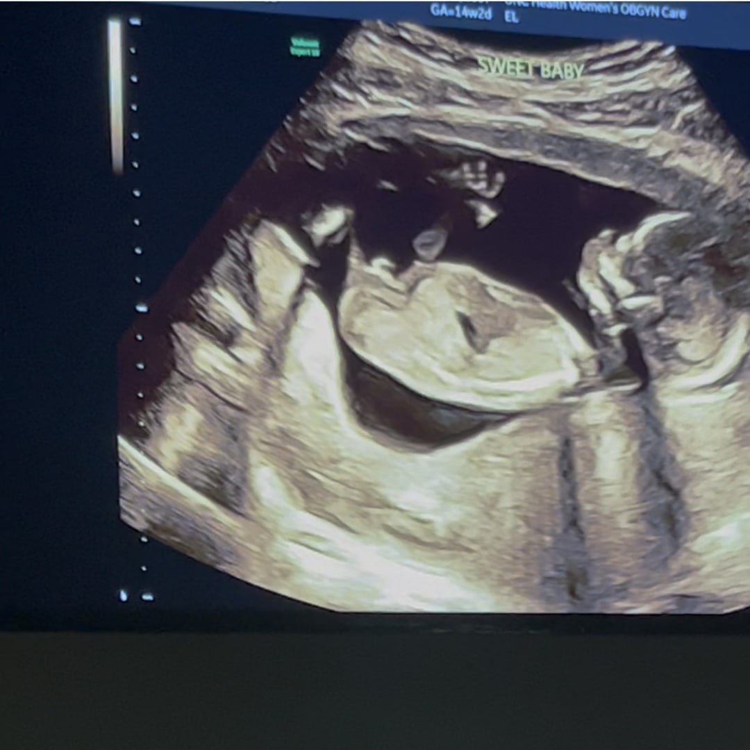 Photo shared by Imani for their Babylist baby registry.