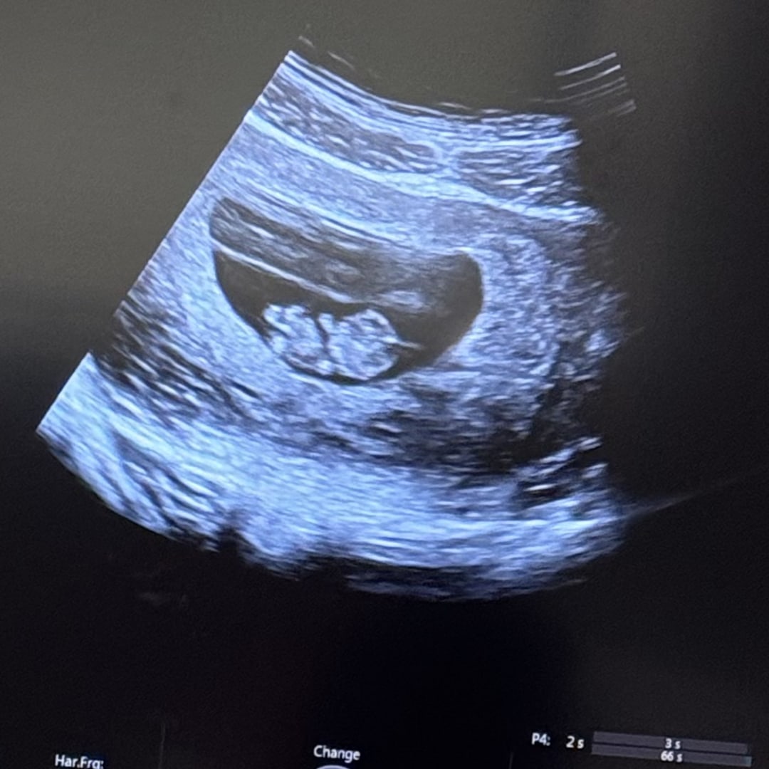 Photo shared by Ashlee for their Babylist baby registry.