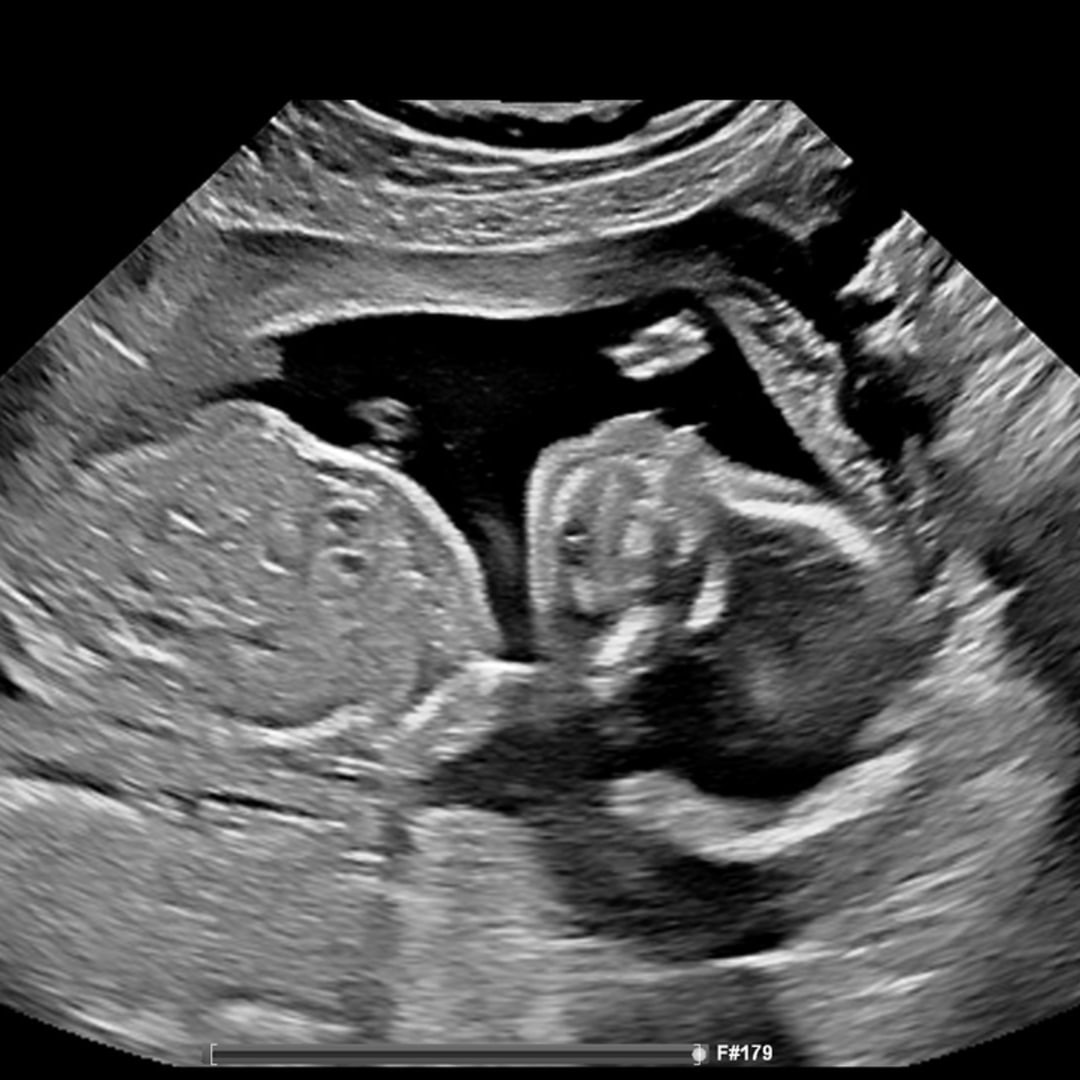 Photo shared by Jennifer for their Babylist baby registry.