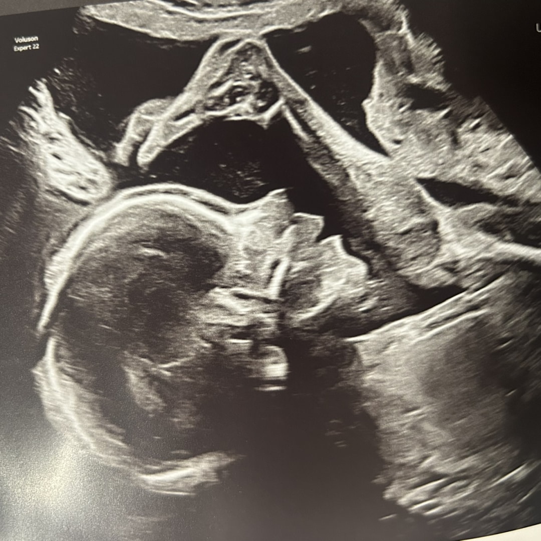 Photo shared by Jordan for their Babylist baby registry.