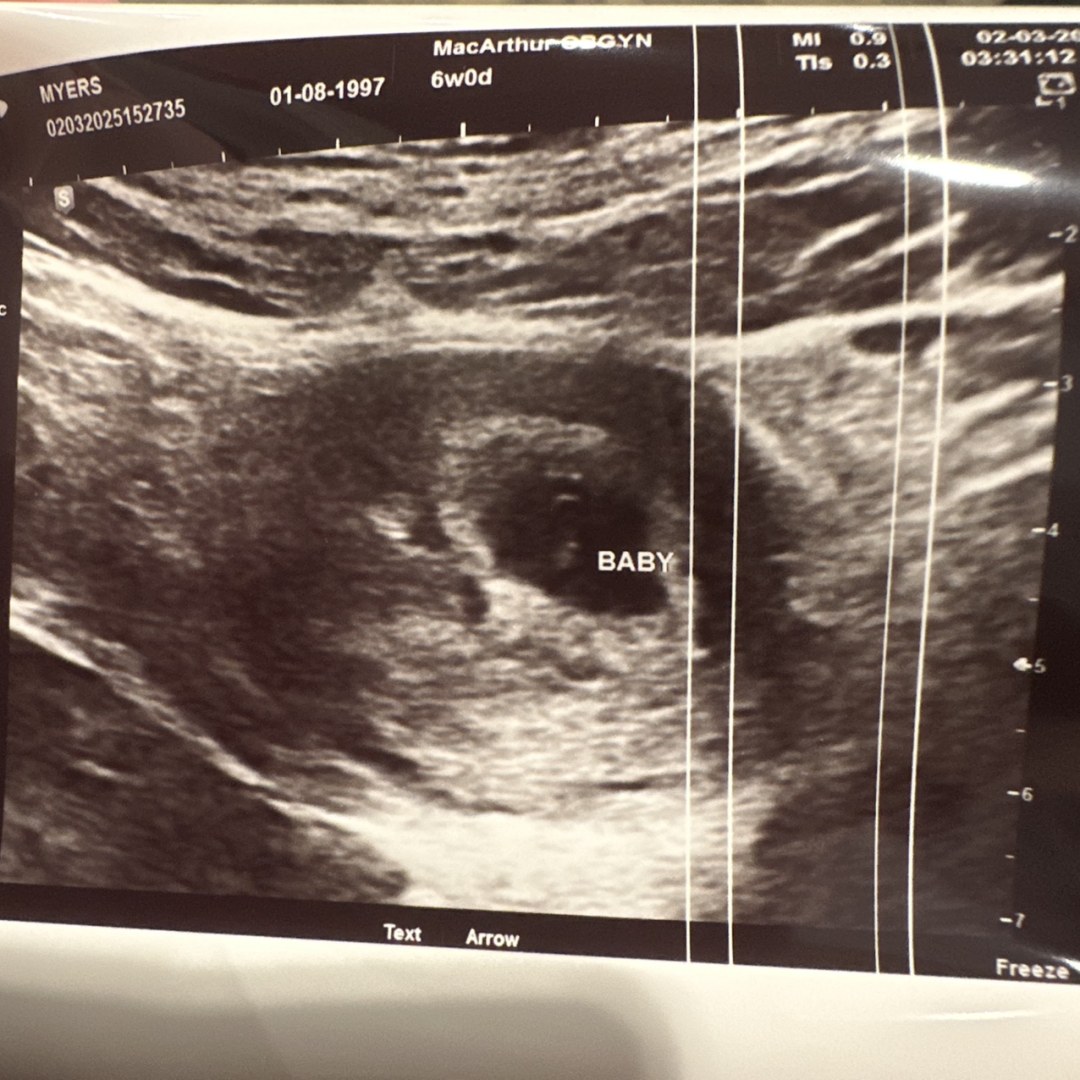 Photo shared by Chanterra for their Babylist baby registry.