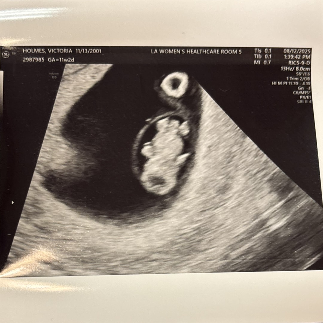 Photo shared by Victoria for their Babylist baby registry.