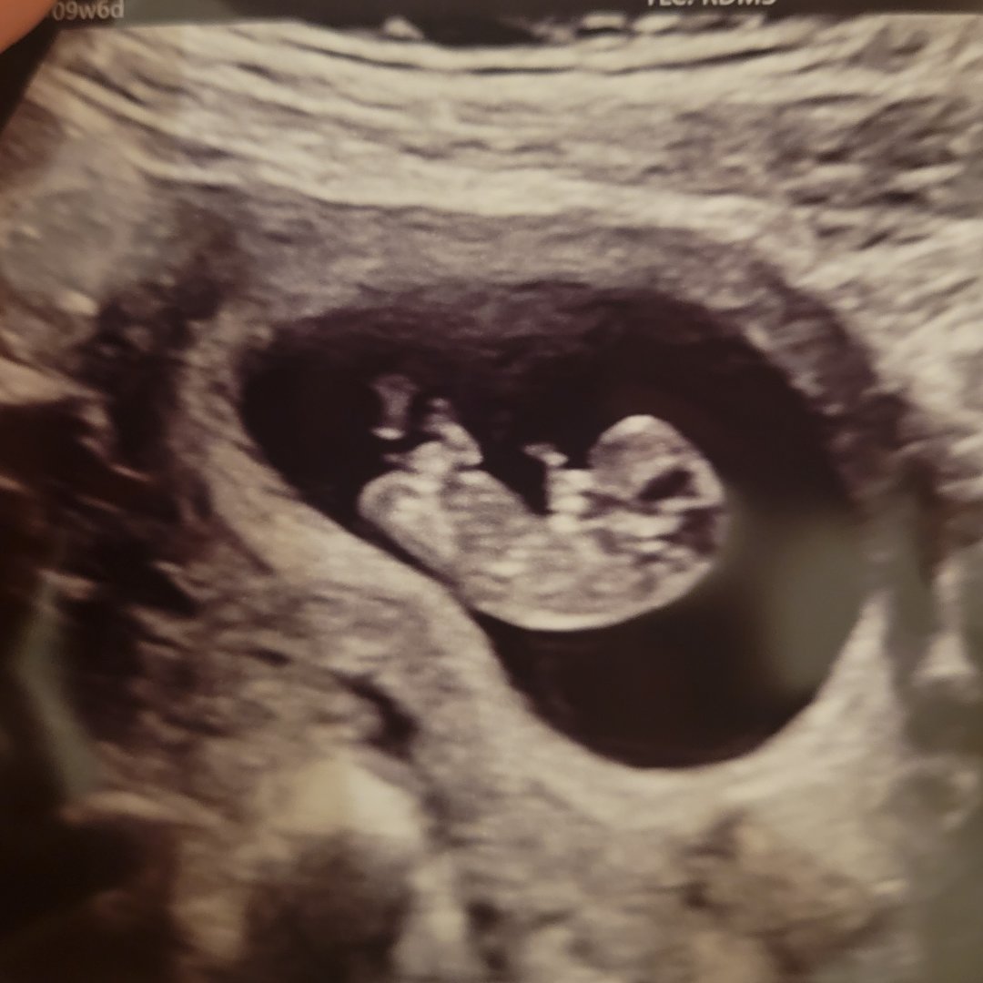 Photo shared by Savannah & Darren for their Babylist baby registry.