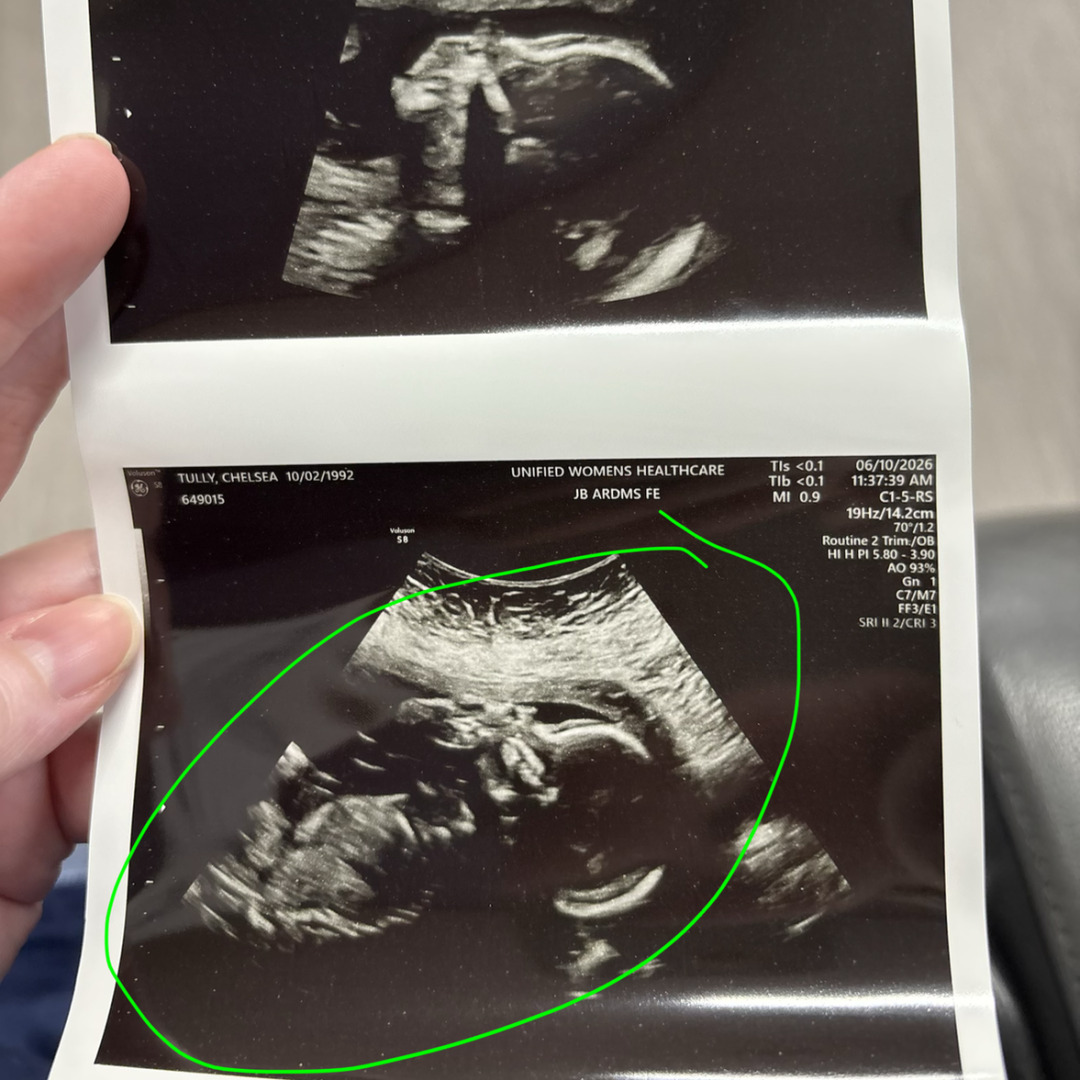 Photo shared by Chelsea for their Babylist baby registry.