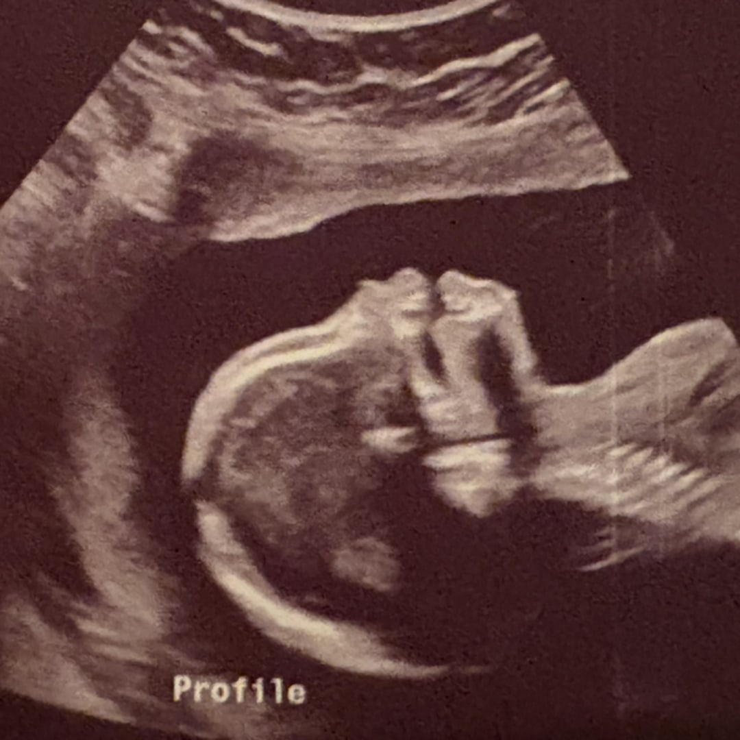 Photo shared by Alexa for their Babylist baby registry.