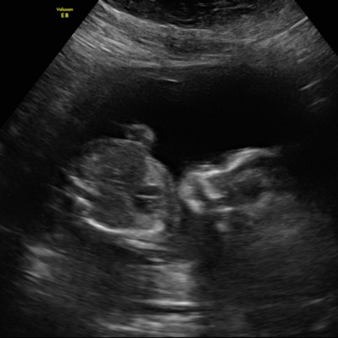 Photo shared by Marlene for their Babylist baby registry.