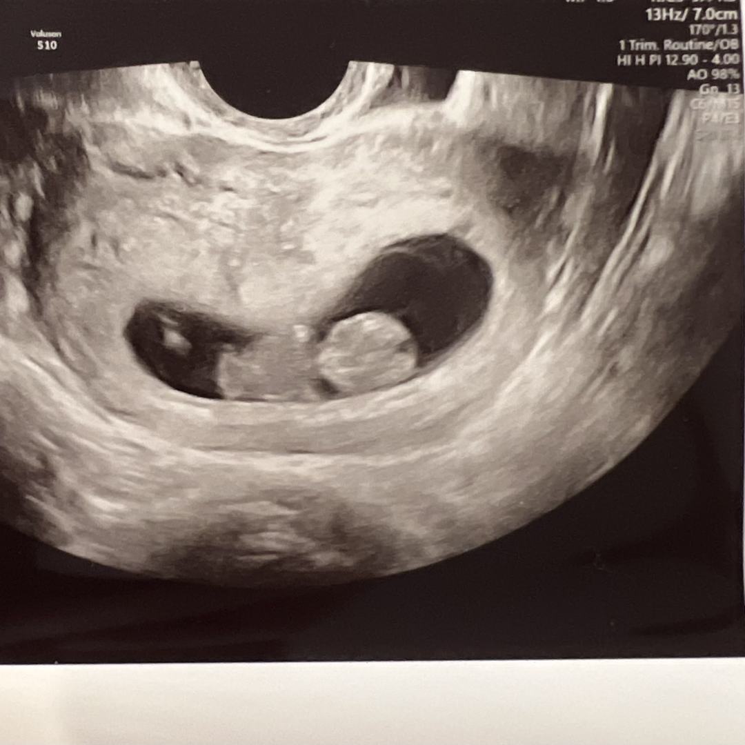 Photo shared by Francis for their Babylist baby registry.