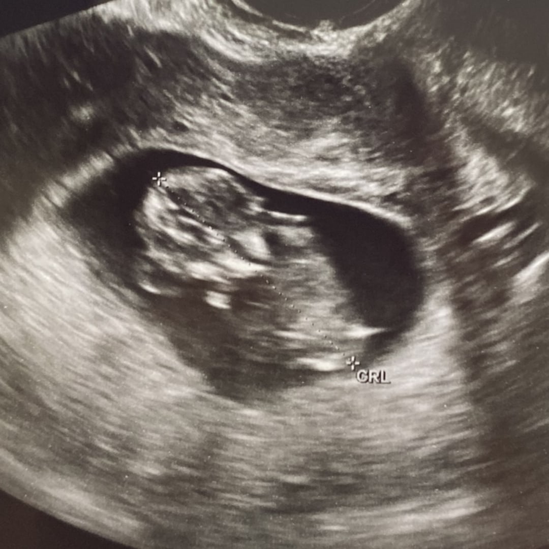 Photo shared by Cati for their Babylist baby registry.