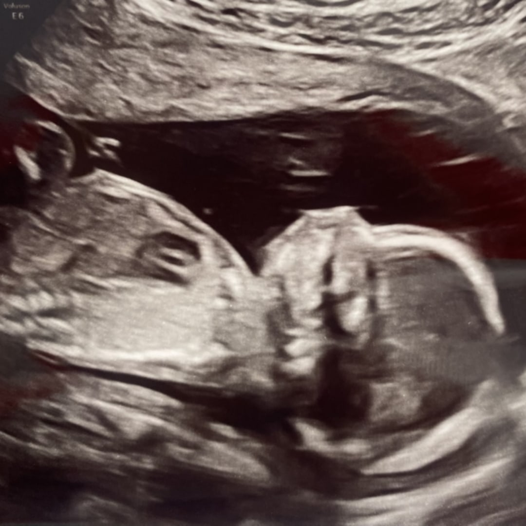 Photo shared by Haley for their Babylist baby registry.