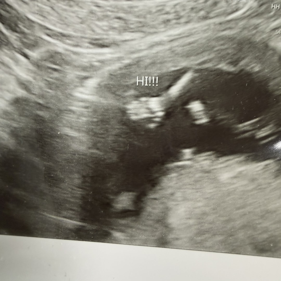 Photo shared by Ema for their Babylist baby registry.