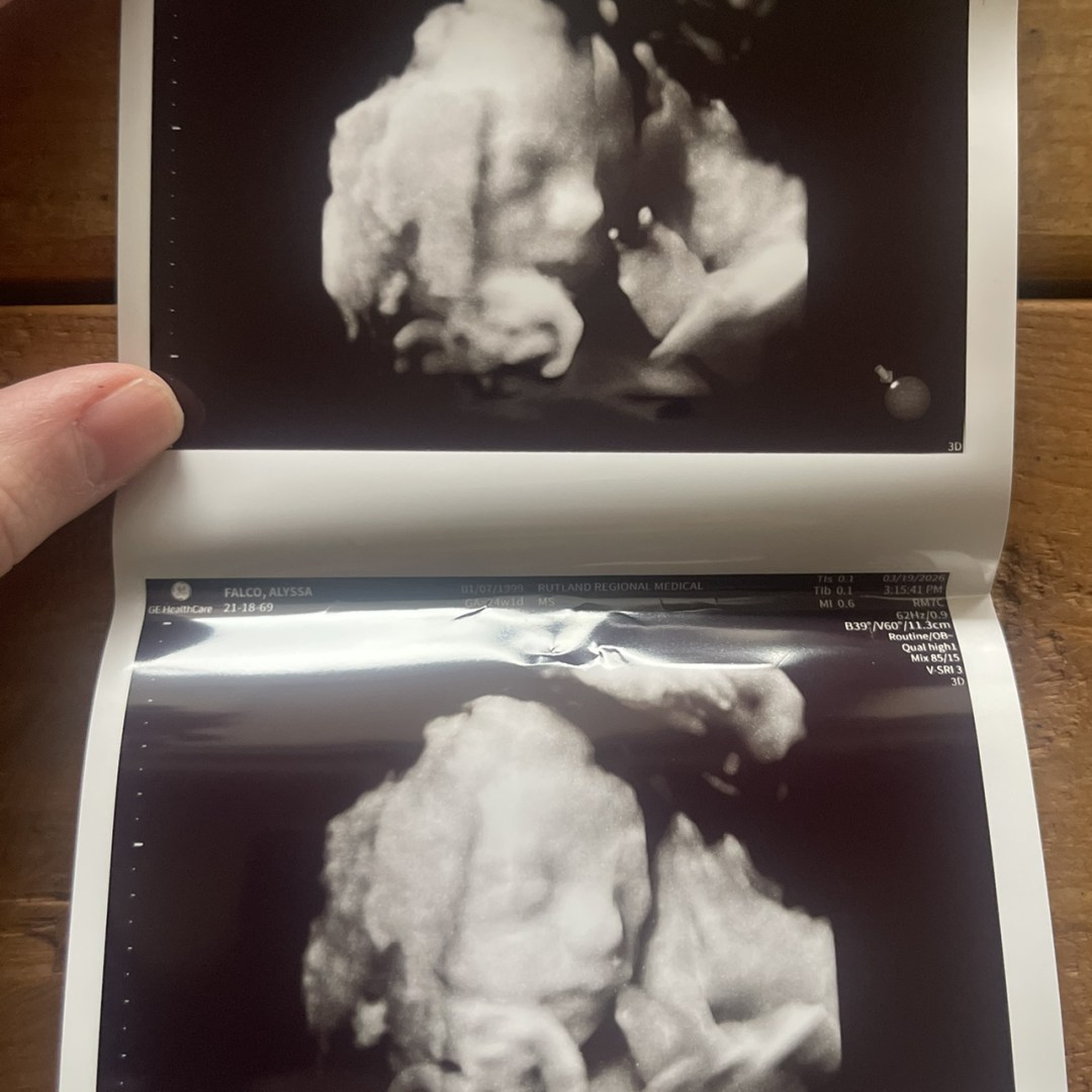 Photo shared by Alyssa for their Babylist baby registry.