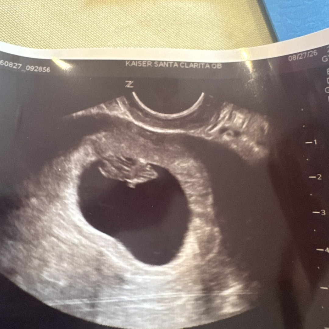 Photo shared by Amanda for their Babylist baby registry.