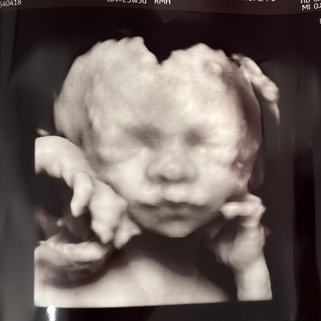 Photo shared by Emily for their Babylist baby registry.