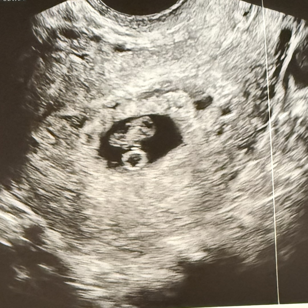 Photo shared by Cereza for their Babylist baby registry.