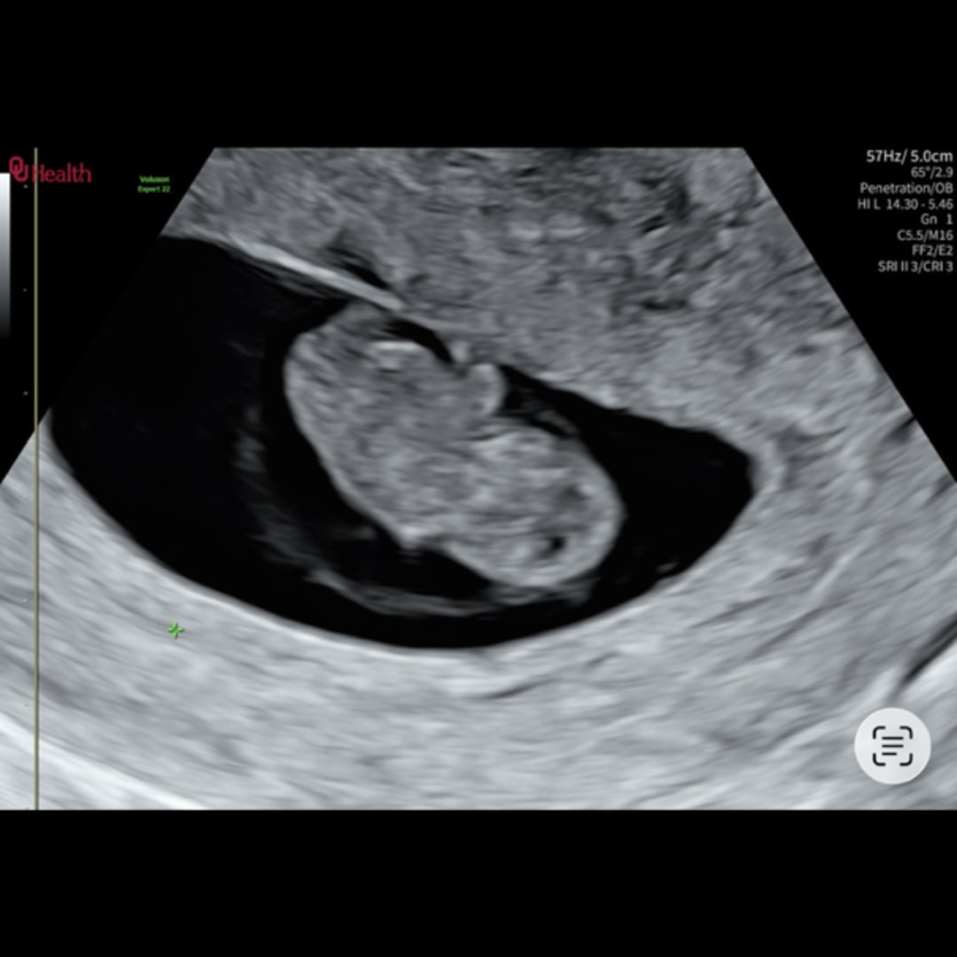 Photo shared by Anna for their Babylist baby registry.