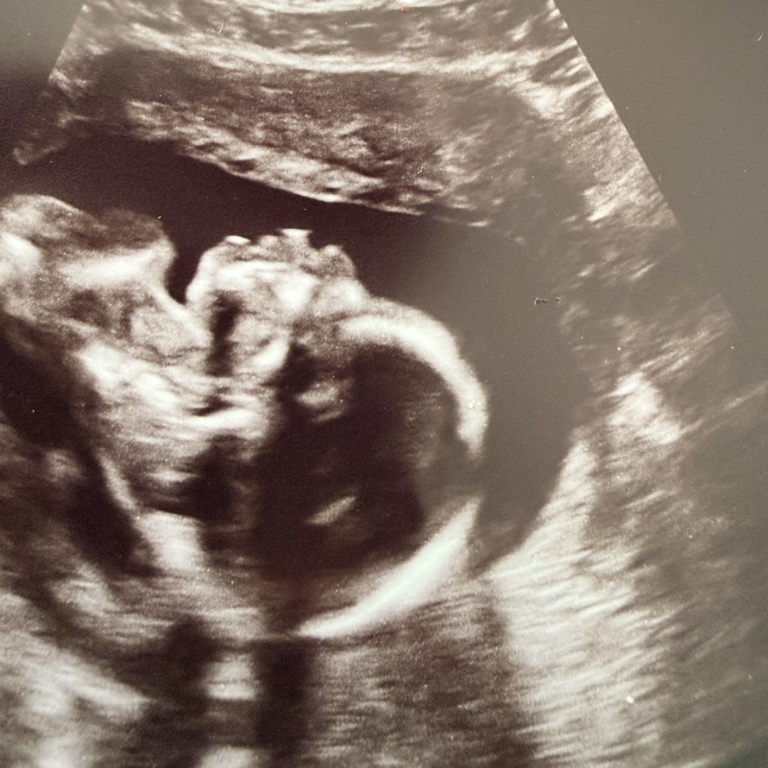 Photo shared by Jordan for their Babylist baby registry.