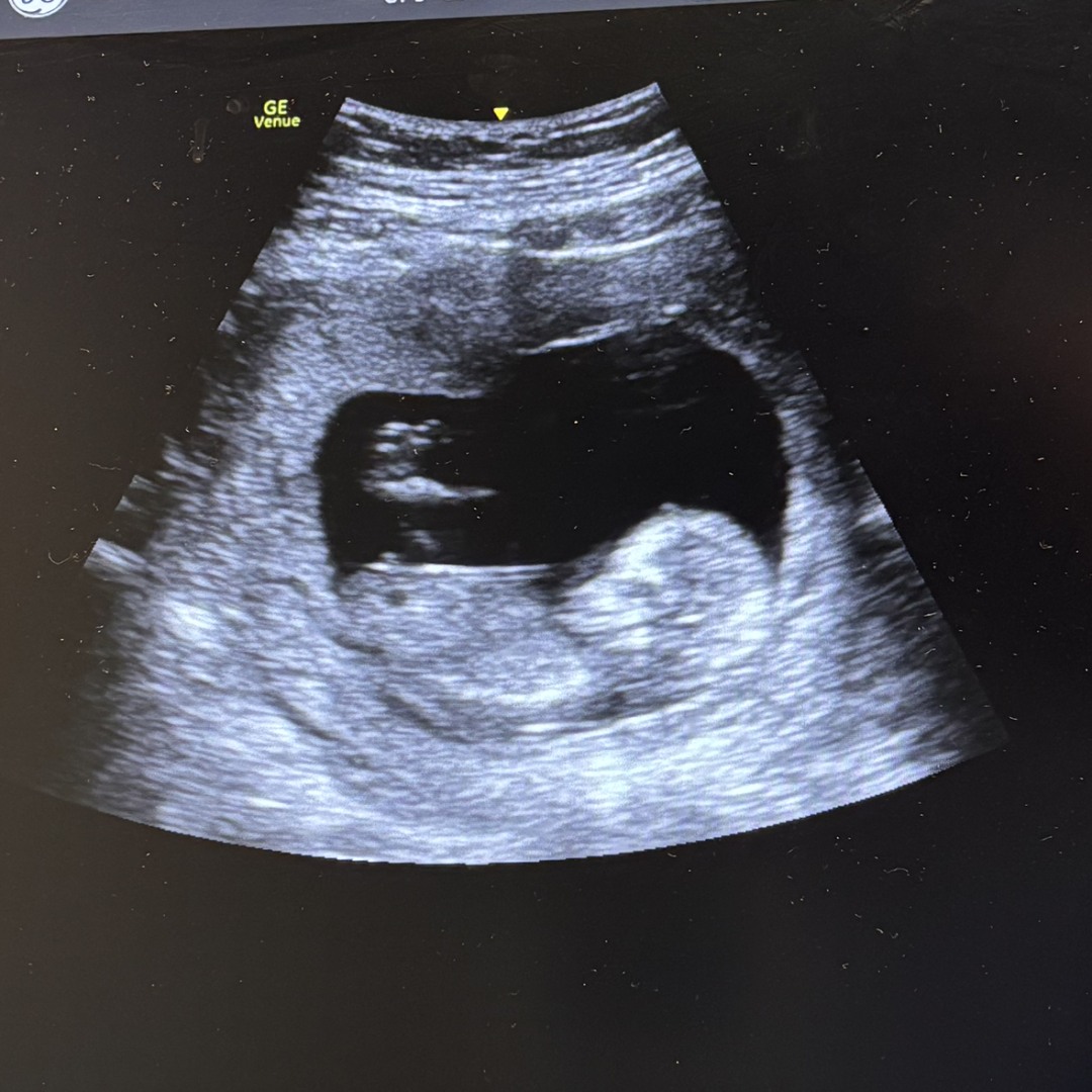 Photo shared by Angel for their Babylist baby registry.