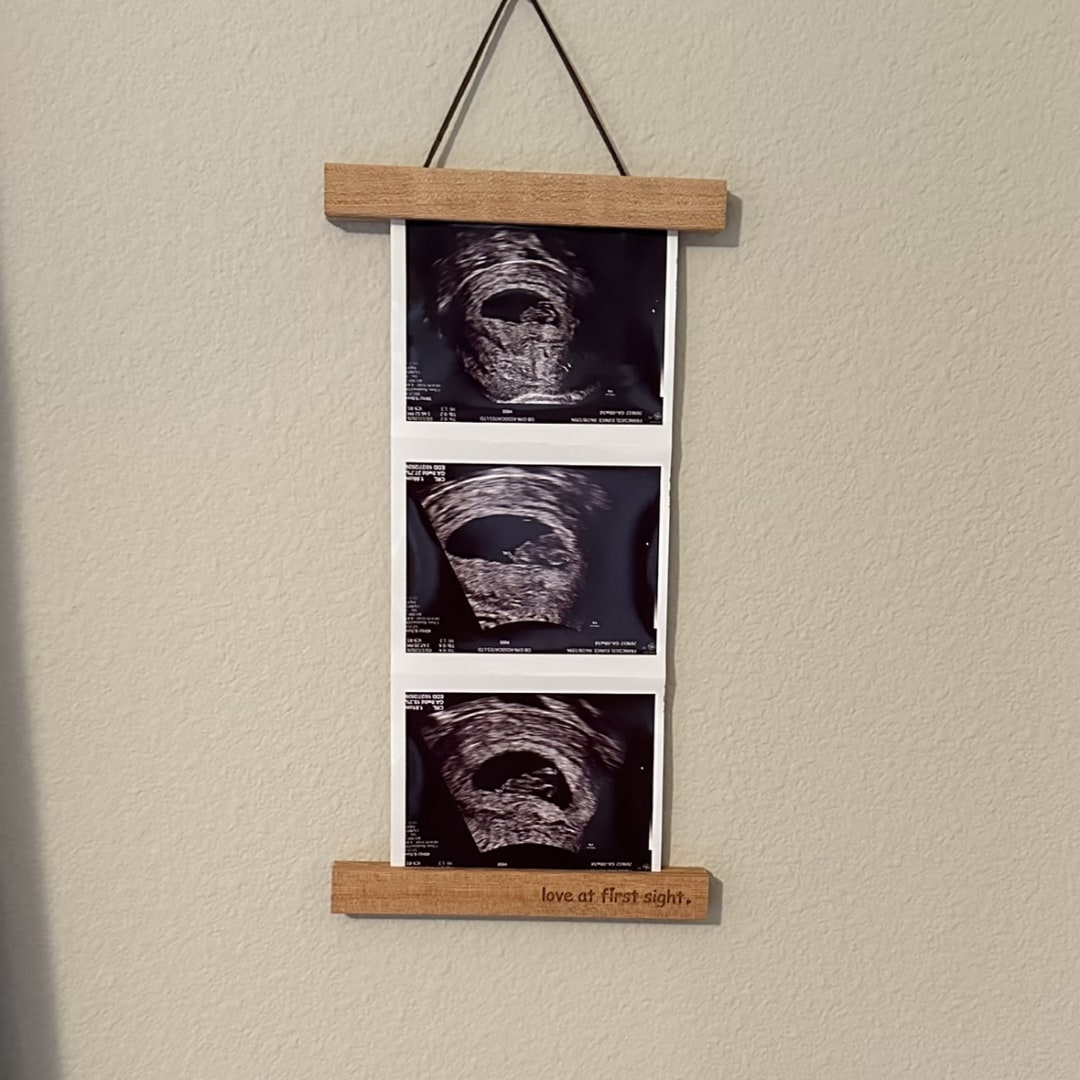 Photo shared by Eunice for their Babylist baby registry.