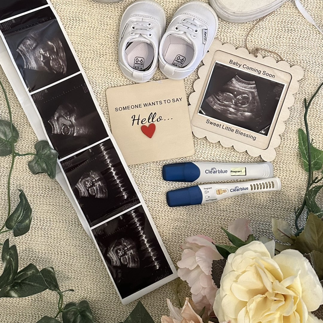 Photo shared by Joan Karla for their Babylist baby registry.