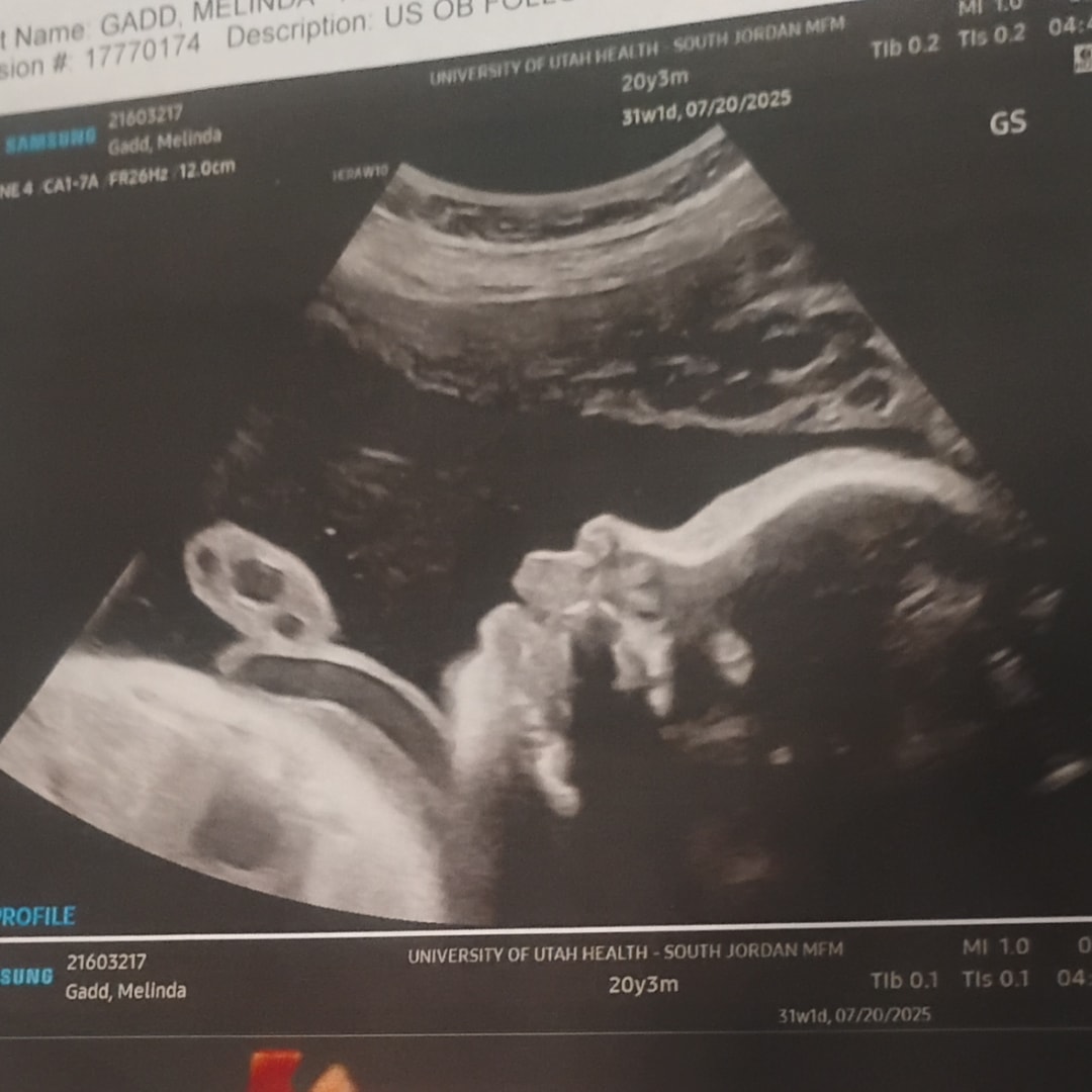 Photo shared by Melinda for their Babylist baby registry.