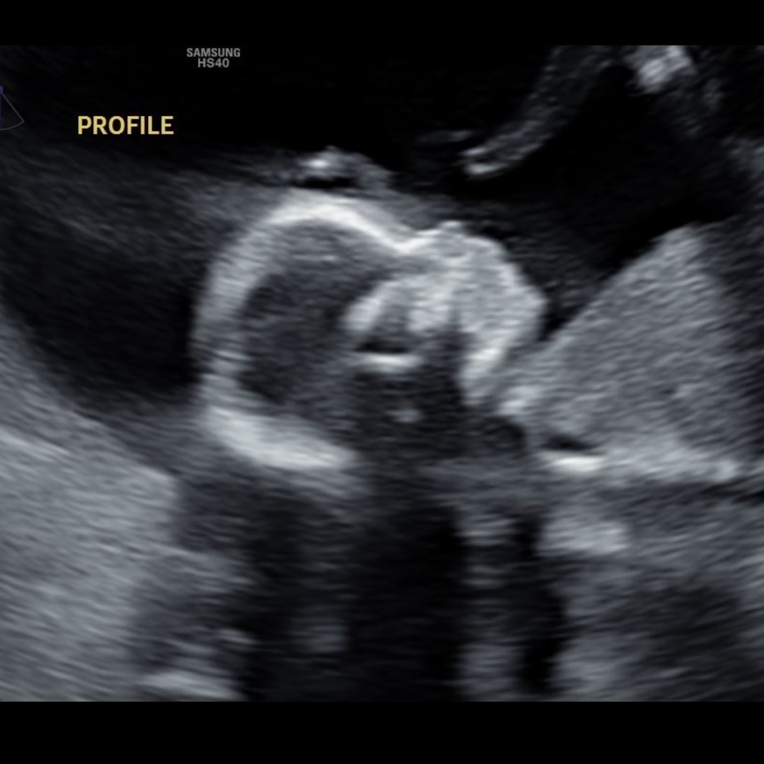 Photo shared by Amanda for their Babylist baby registry.