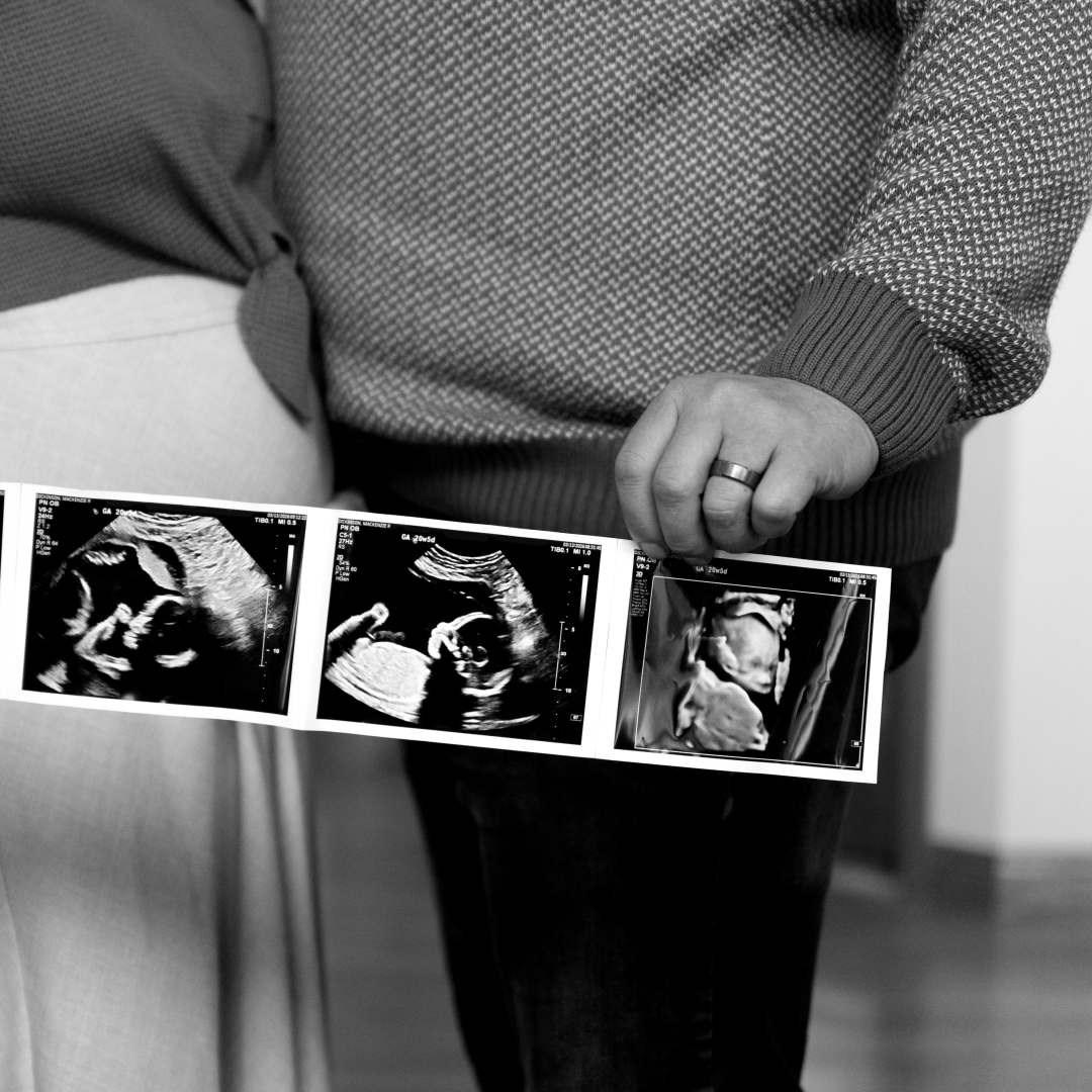 Photo shared by Mackenzie for their Babylist baby registry.