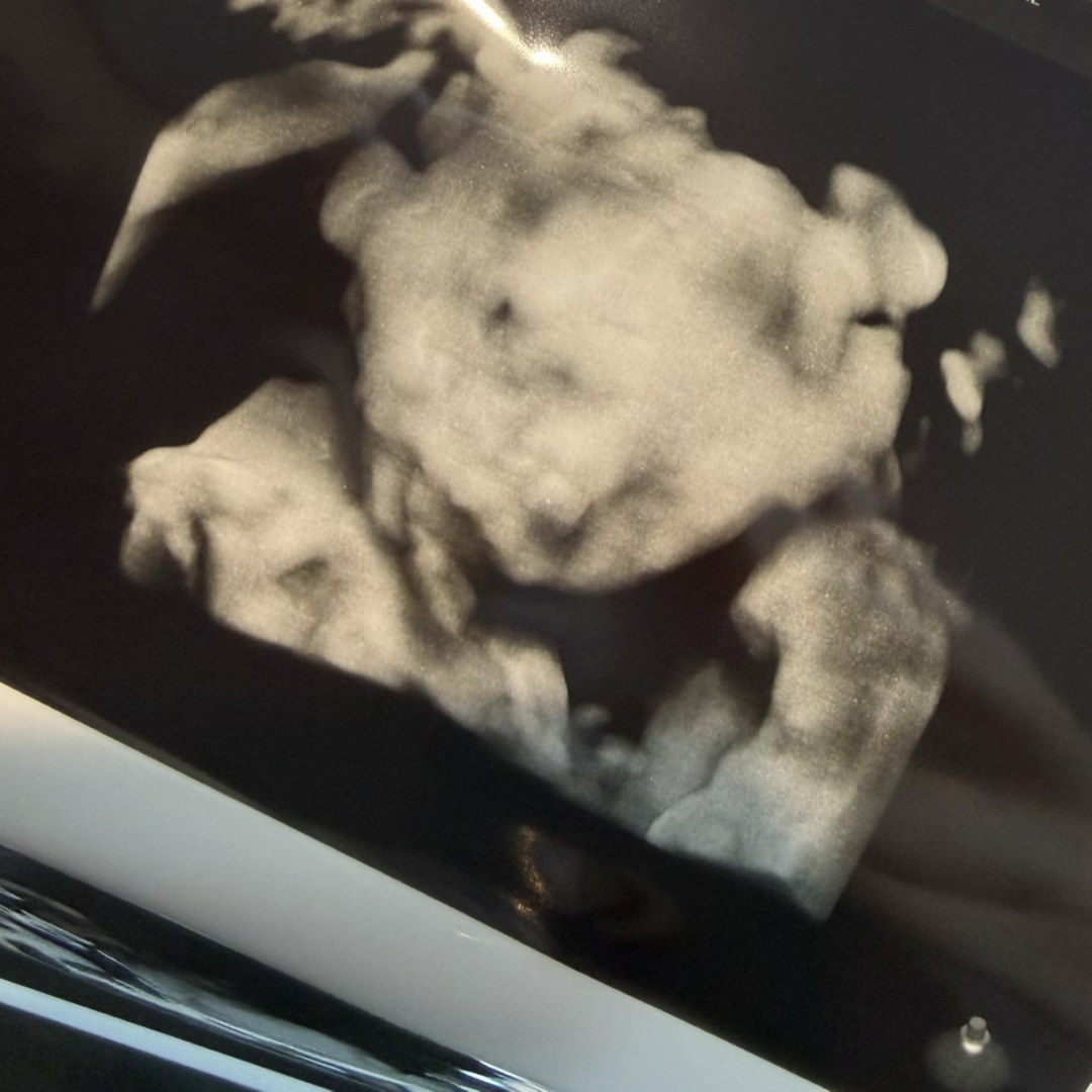 Photo shared by Angela for their Babylist baby registry.