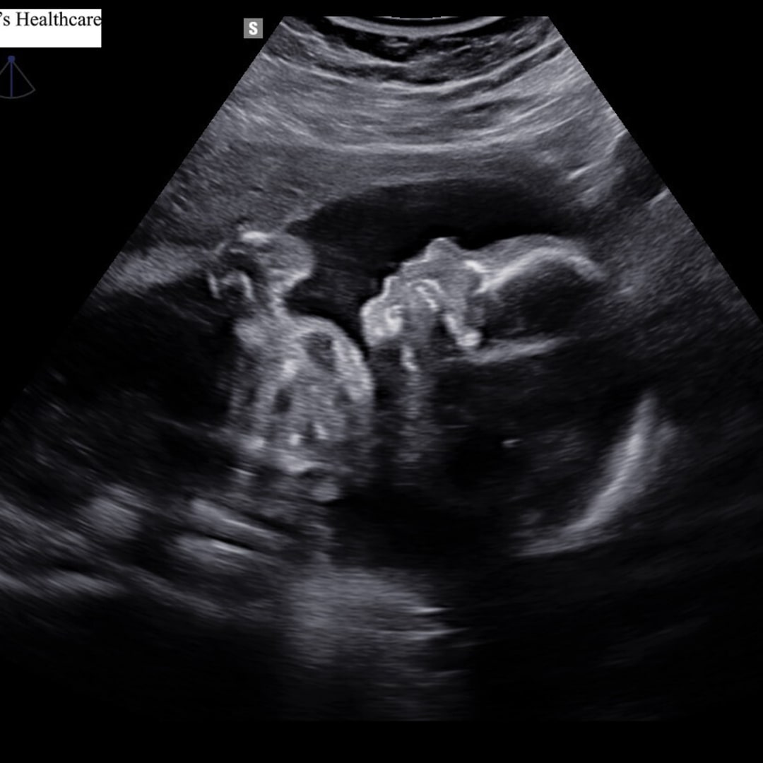 Photo shared by Alyssa for their Babylist baby registry.