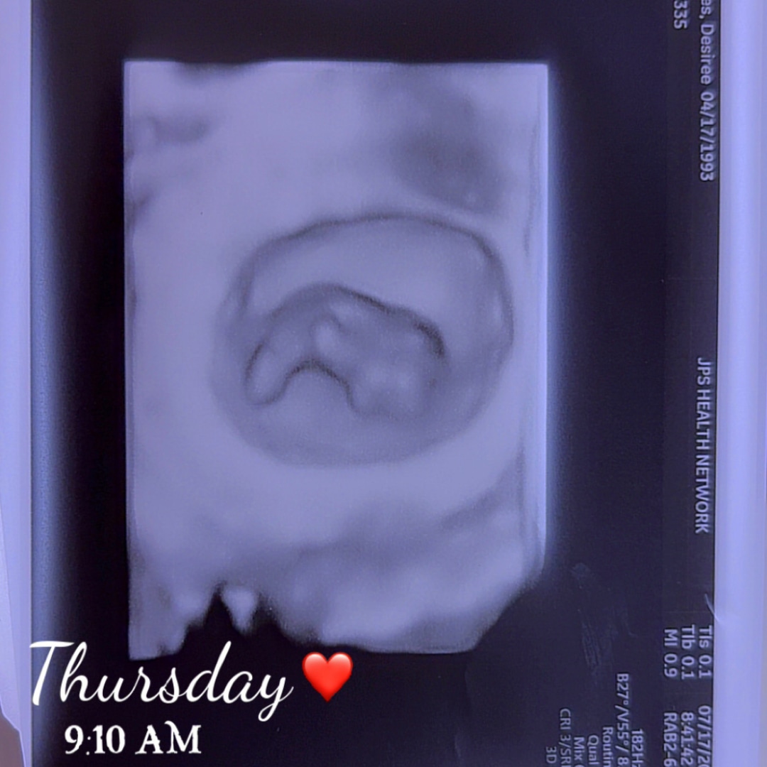 Photo shared by Desiree for their Babylist baby registry.