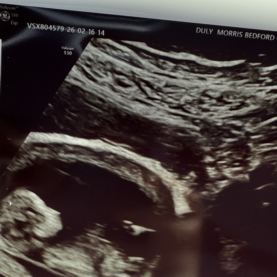Photo shared by Danielle for their Babylist baby registry.